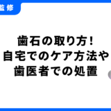 歯石 取り方