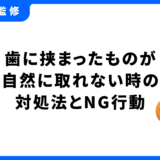 歯に挟まった 自然に取れる