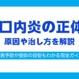 口内炎 白い 治し方