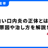 口内炎 白い 治し方