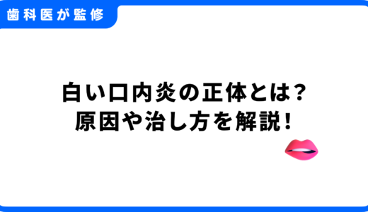 白い口内炎の正体とは？原因や治し方を解説！再発予防や受診の目安もわかる完全ガイド