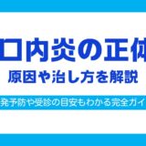 口内炎 白い 治し方