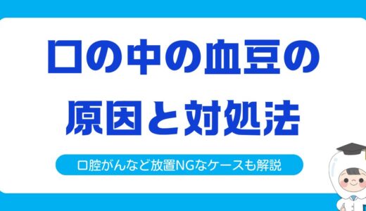 【歯科医監修】口の中の血豆の原因と対処法｜口腔がんなど放置NGなケースも解説