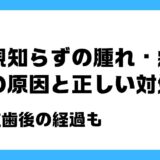 親知らず 腫れ