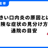 口内炎 大きい