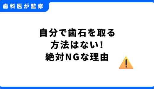 【歯科医が警告】自分で歯石を取る方法はない！絶対NGな理由と歯石予防法