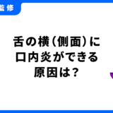 口内炎 舌 側面 原因
